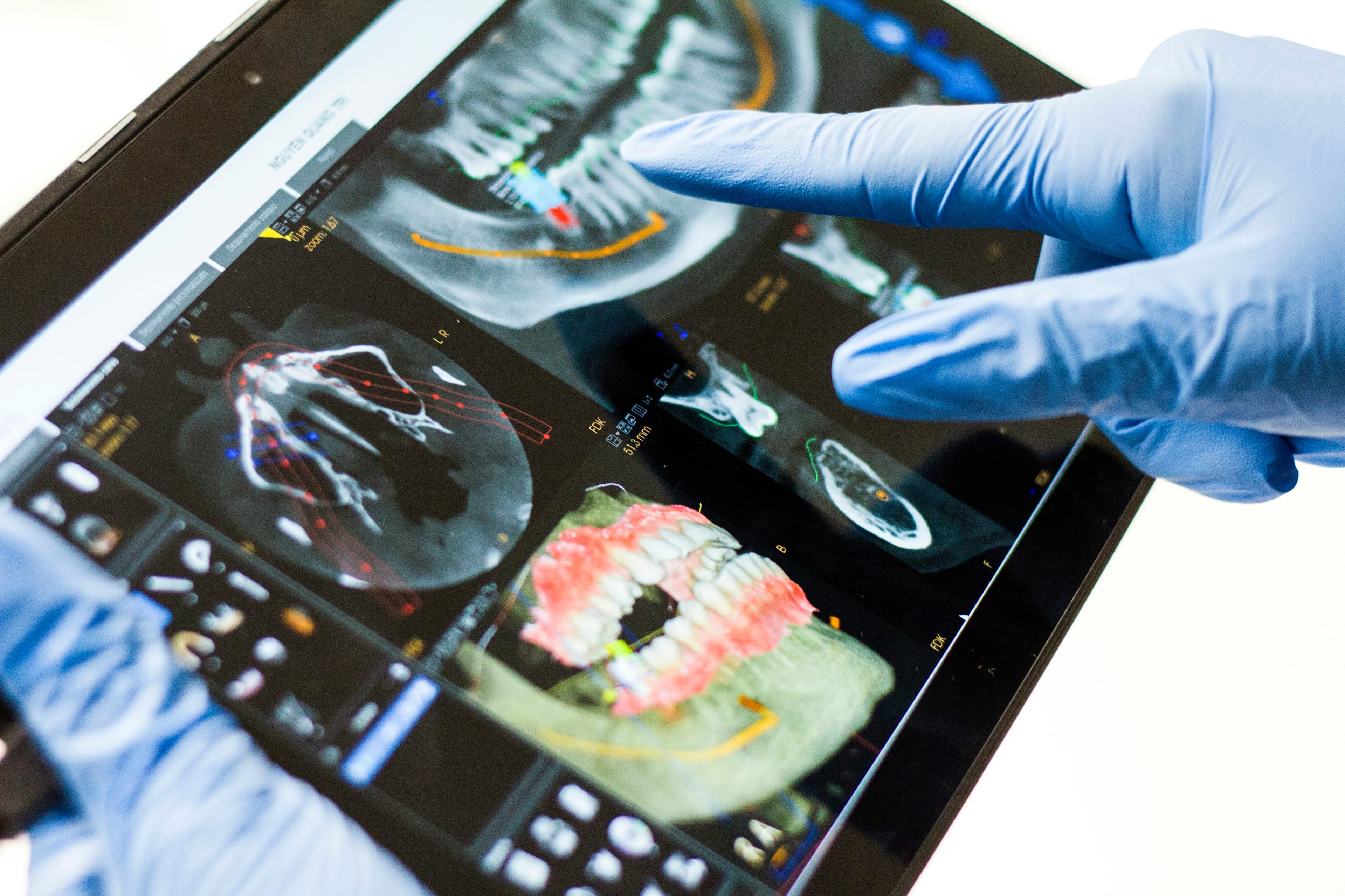 Dentista señalando una radiografía en una tableta.