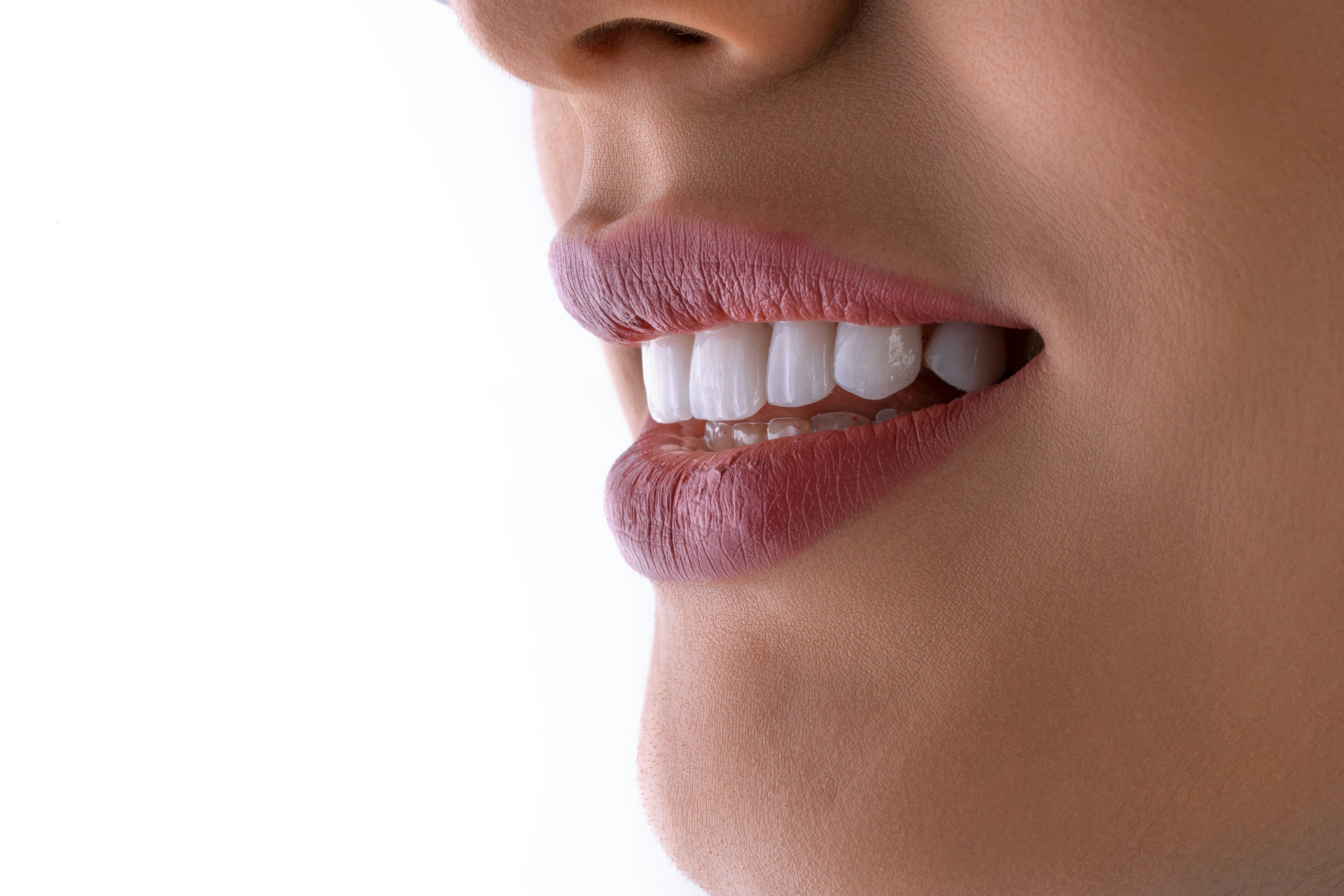 Primer plano de una sonrisa con dientes blancos.