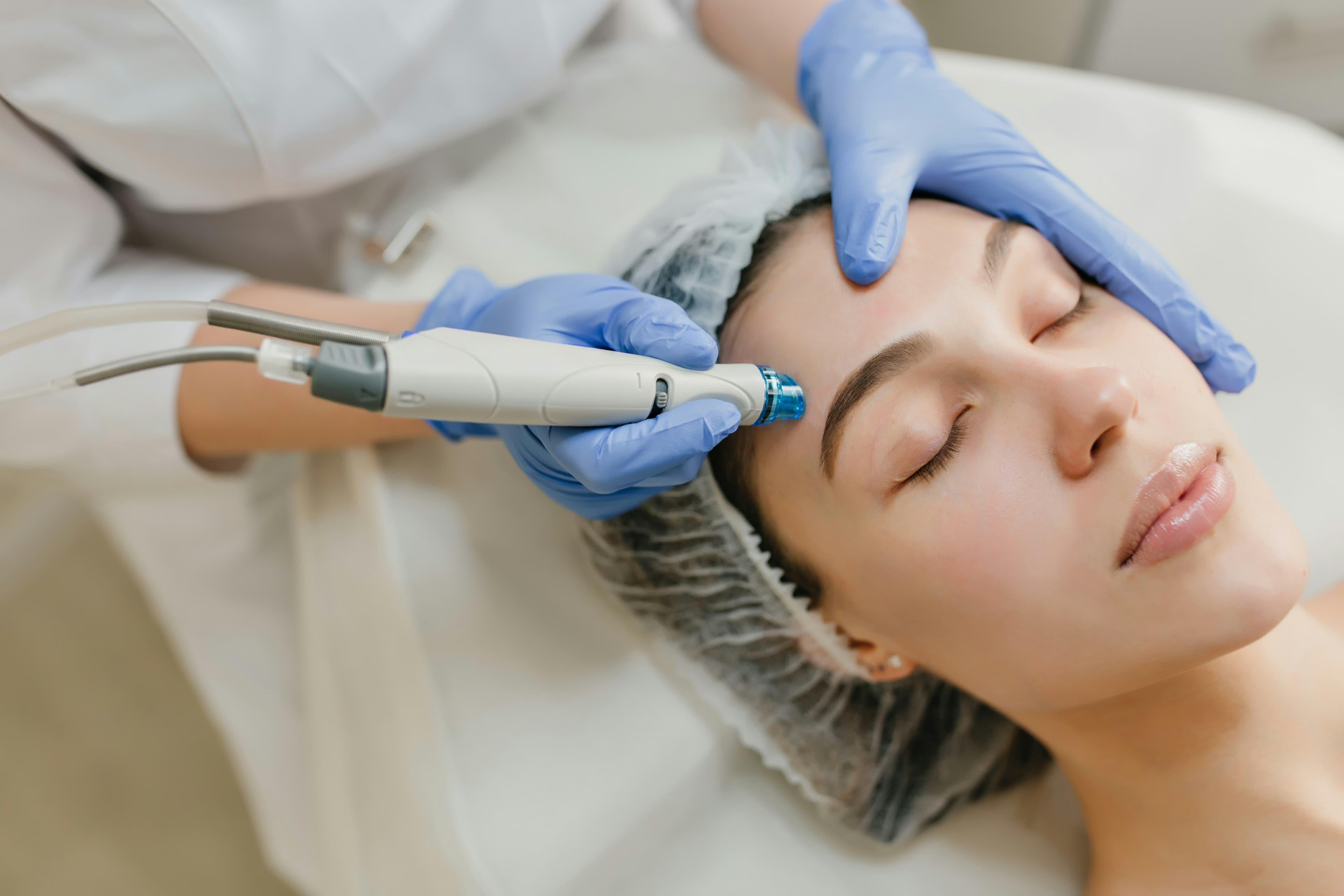 Especialista aplicando un peeling facial.